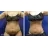 Chicago Liposuction