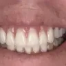 Aspen Dental - Dentures