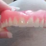 Aspen Dental - Dentures