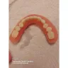 Aspen Dental - Dentures