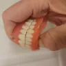 Aspen Dental - Dentures