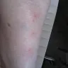 Priceline.com - bed bugs and my bites in my las vegas, nv hotel arizona charlie's